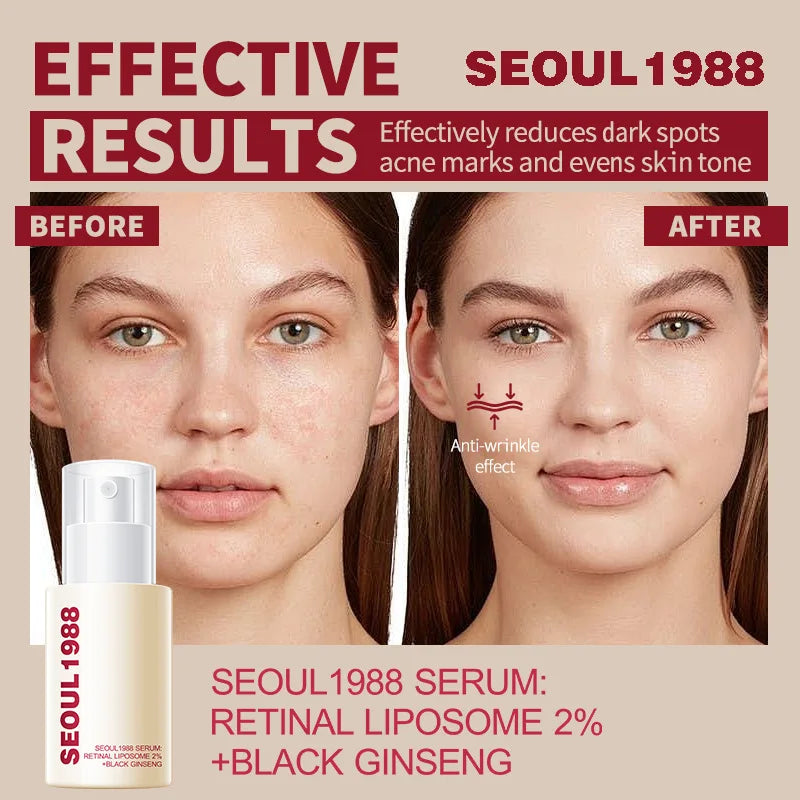 SEOUL 1988 Retinol Face Serum